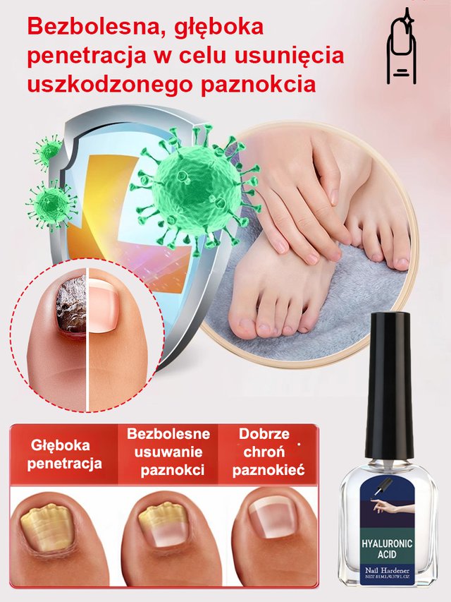 JC przeciwgrzybiczy płyn do regeneracji paznokci