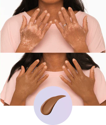 💜Ostatni dzień – kup 1, a 1 dostaniesz gratis!💜✨Body Perfector – wodoodporny, lekki i nieskazitelny makijaż ciała