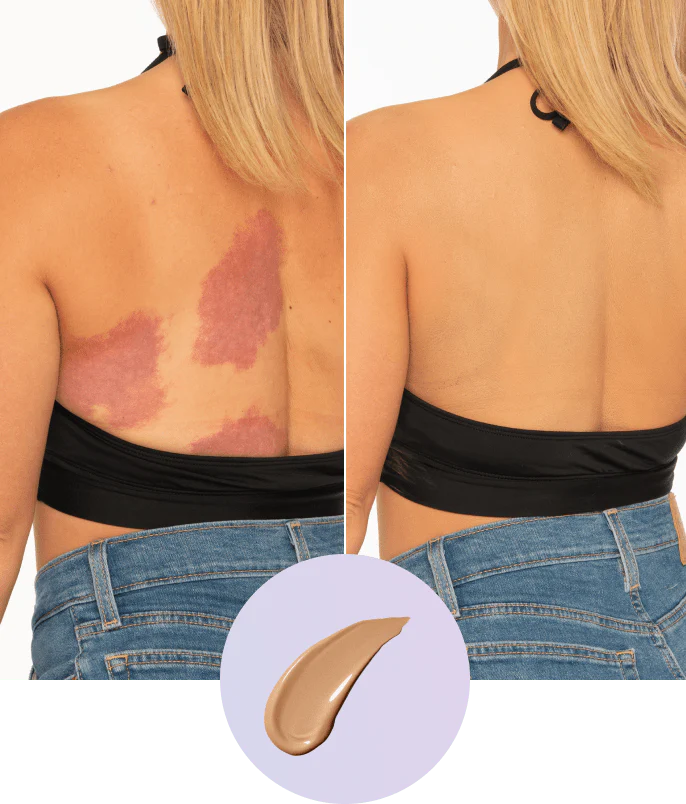 💜Ostatni dzień – kup 1, a 1 dostaniesz gratis!💜✨Body Perfector – wodoodporny, lekki i nieskazitelny makijaż ciała