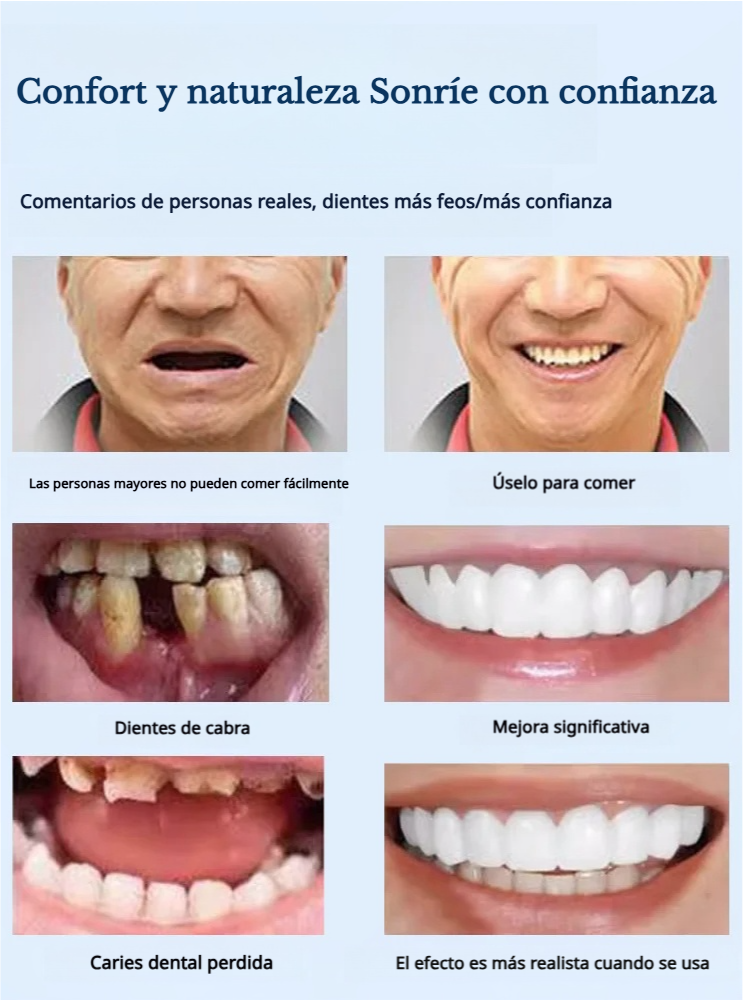 Simulación de blanqueamiento de protesis nastaviteľné pomocou prichytenia 