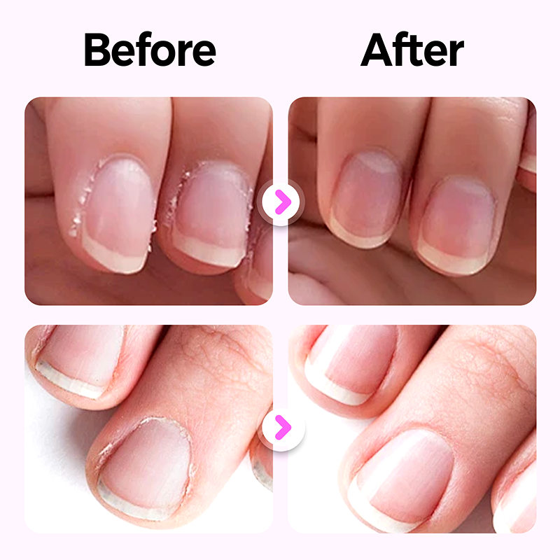 💜Kup 1, drugi gratis💜2025 Nowy, ulepszony długopis do pielęgnacji paznokci 3 w 1💅