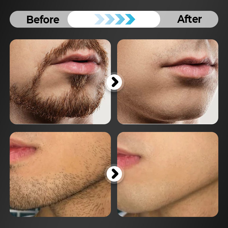 🪒✨6-ostrzowa maszynka do golenia z łatwo zdejmowanymi głowicami